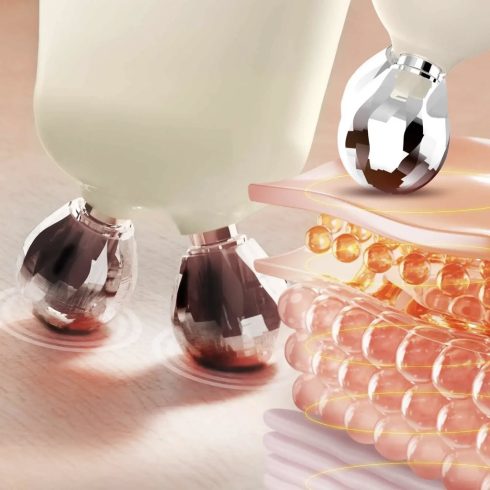 NENO Beauty Algo arcformázó készülék 